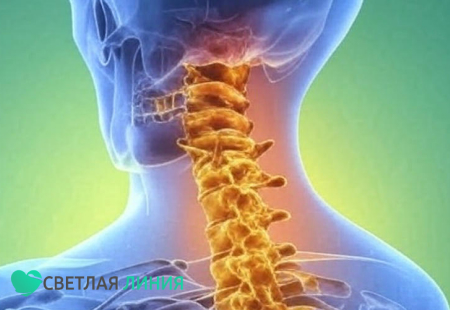 Остеохондроз в позвоночнике
